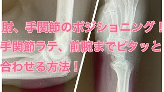 手関節、肘関節のレントゲン＊ポジショニング＊簡単そうだけど、コツがあるんです！