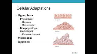 Dysplasia cell adaptation (usmle patho)