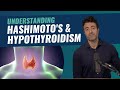 Does Hashimoto's Lead to Hypothyroidism? Rethinking Risk