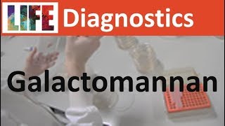 Galactomannan testing for disseminated Aspergillus/Talaromyces/Histoplasma infections