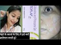 Why do I use it? Toplap Gel For Skin All Details || चेहरे पर में इसे क्यों इस्तेमाल करती हूं?