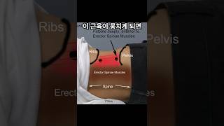 자주 허리가 뻐근하거나 골반 위부터 엉덩이까지 아프다면 이 근육을 스트레칭하세요