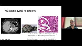 Approach to cystic lesions in the pancreas - Dr Sudipta Dhar Chowdhury