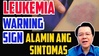 Leukemia Warning Signs: Alamin ang Sintomas – by Doc Willie Ong #973