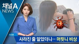 사라진 줄 알았더니…어린이 ‘머릿니 주의보’