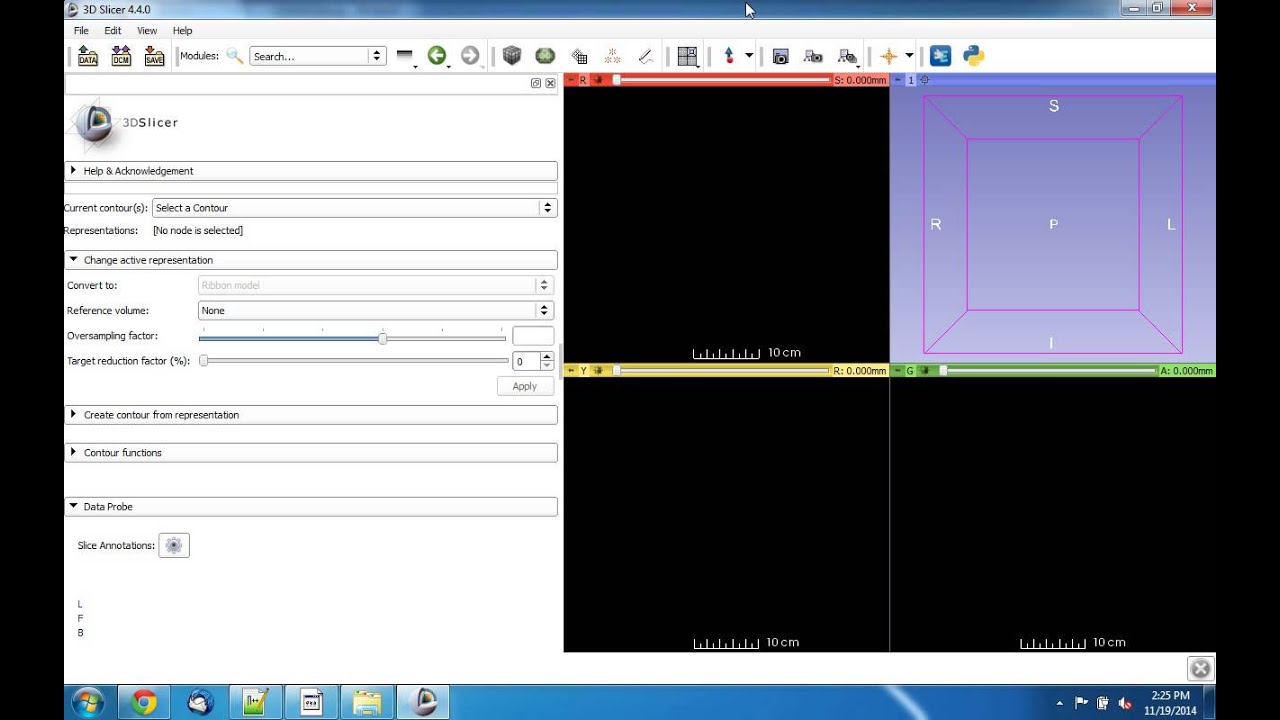 Slicer Python Module Creation Tutorial Youtube