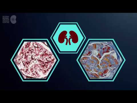 What is atypical haemolytic uraemic syndrome?