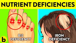 7 Incredibly Common Nutrient Deficiencies