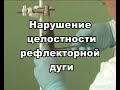 Время рефлекса рецептивное поле рефлекторная дуга