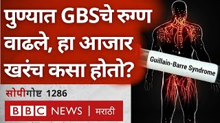 Pune GBS Disease Explained: Guillain Barre Syndrome काय? यामुळे Immune System कशी बदलते? सोपी गोष्ट