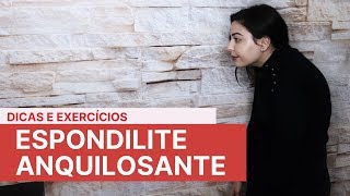 Espondilite Anquilosante: Os Melhores Exercícios | Saúde Minuto