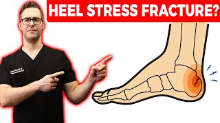 Calcaneus Heel Stress Fracture Treatment [Squeeze Test & Recovery!]