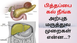 பித்தப்பை கல் நீங்க அற்புத மருத்துவ முறைகள் என்ன