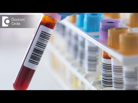 What are the tests for Chronic Kidney Disease? - Dr. Vishwanath. S What are the tests for Chronic Kidney Disease? - Dr. Vishwanath. S