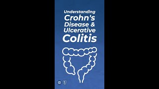 Understanding Crohn's Disease & Ulcerative Colitis | #shorts