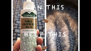 Wild Growth Hair Oil Bald To Beautiful 35 Days Day 0 Tiyona