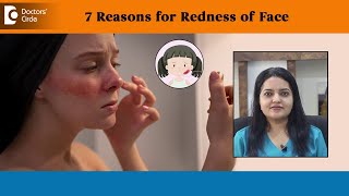 7 Reasons for Redness of Face| Erythema, Sunburn, Rosacea - Dr. Urmila Nischal | Doctors' Circle