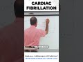 Cardiac Fibrillation #drnajeeb #drnajeeblectures #shortvideo