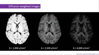 BrainMap: On the quantification of axon diameter distributions using diffusion MRI