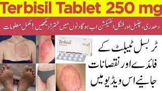 Terbisil Tablet 250mg | Terbinafine Tablet |Best Medicine For Fungal Infection | Side Effects | Uses