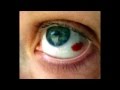 Red Spot on my Eye Red Spot on my Eye