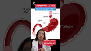 Peptic Ulcers: Medical Surgical SHORT | @LevelUpRN