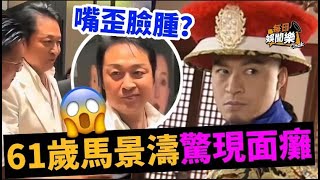 面癱亮相！61歲馬景濤嘴歪臉腫現身引熱議，粉絲擔心可能中風先兆