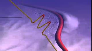 Lateral buckling of pipeline (nonlinear contact with soil) with imperfection OSS