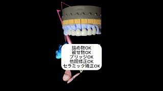 🦷日本最安値🦷オールジルコニアセラミック🦷￥19800×tax／本🦷 #歯医者大阪 #セラミック治療 #歯医者 #白い歯 #セラミック #セラミック矯正 #ジルコニアセラミック #銀歯