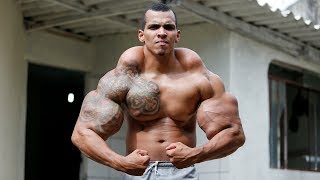 Muscle Injections Almost Cost This Man His Arms