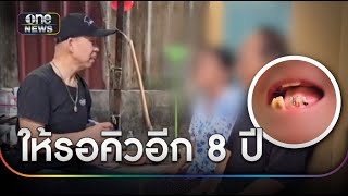 ชายพาป้าไปหาหมอฟัน รพ. บอกรอ 8 ปี | ข่าวเช้าช่องวัน | สำนักข่าววันนิวส์