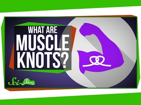 What Are Muscle Knots? What Are Muscle Knots?