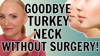 How To Get Rid Of Turkey Neck - NO SURGERY or EXPENSIVE TREATMENTS!