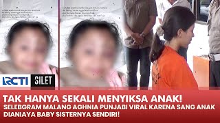 MIRIS! Selebgram Malang Ngaku Anaknya Tak Hanya Sekali Dianiaya Baby Sitter! | SILET