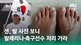 션, 독립유공자 후손 위한 마라톤도…발 사진 보니 '어마어마' / JTBC 뉴스5후