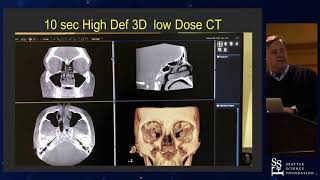 Nuances of Endoscopic Endonasal Approach for Sellar Lesions: Less is More - Chester F Griffiths, MD