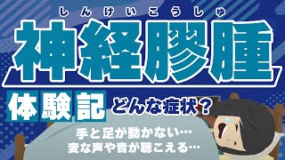 【神経膠腫】どんな病気？ある日突然こんな症状が...！？