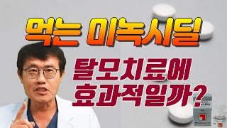 먹는 미녹시딜, 탈모치료에 효과적일까? (ft. 미녹시딜정 복용)