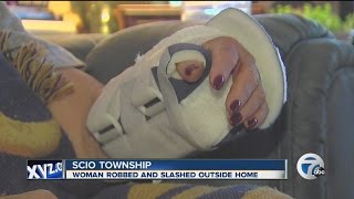 Woman slashed during robbery