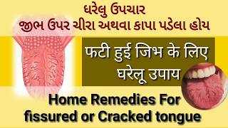 ધરેલુ ઉપચાર જીભ ઉપર ચીરા અથવા કાપા પડેલા હોય | Home Remedies For Fissured And Cracked Tongue