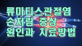 류마티스관절염(Rheumatoid Arthritis) 저림증상이 나타나는 이유와 대처방법