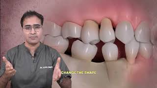 Importance of Teeth in Smiling Face | By Dr. Jugal Panchal