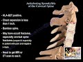 Ankylosing Spondylitis Of The Cervical Spine - Everything You Need To Know - Dr. Nabil Ebraheim