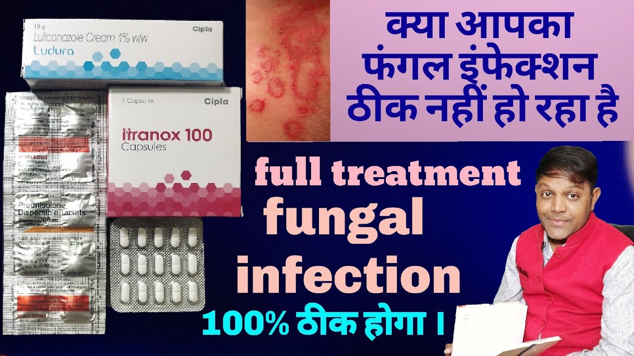 Fungal Infection Full Treatment, Fungal Infection Symptoms, Reason And ...