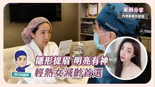 【嘉仕美】還再割雙眼皮❓ #隱形提眉 讓你不再眉壓眼 瞬間喚回年輕有神容貌🌸 #陳世翰醫師