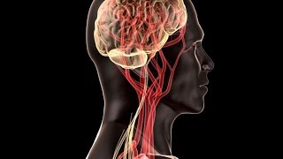 Temporal Arteritis