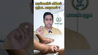 கால்களில் வீக்கம் ஏற்பட காரணம்|Ankle swelling causes|Foot swelling reasons|Pedal edema Causes tamil