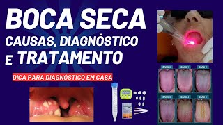 BOCA SECA, hipossalivação e xerostomia: causas, diagnóstico e tratamento! #xerostomia #bocaseca