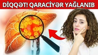 QARACİYƏR YAĞLANMASININ Ən Vacib Əlaməti - Buna Diqqət!