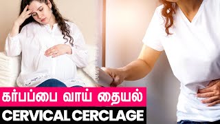 கர்ப்பபை வாய் தையல் | Cervical Cerclage | Dr. Priya Kalyani